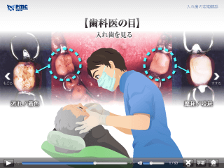 入れ歯の定期健診