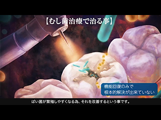 歯を失うという事