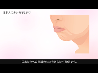 解説：日本人に多い梅干しジワ