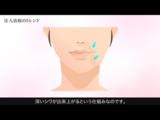 解説：注入治療のトレンド