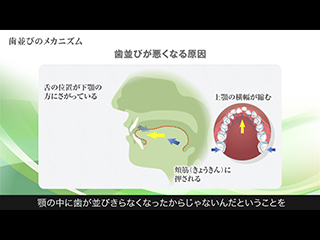 解説：歯並びのメカニズム