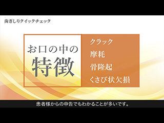 解説：歯ぎしりクイックチェック
