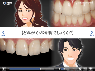 自費治療のかぶせ物