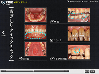 歯ぎしりクイックチェック
